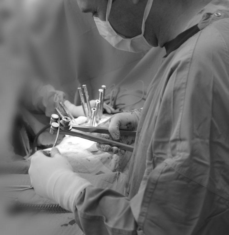 Minimálisan invazív gerinc stabilizációs műtét — intraoperatív felvétel